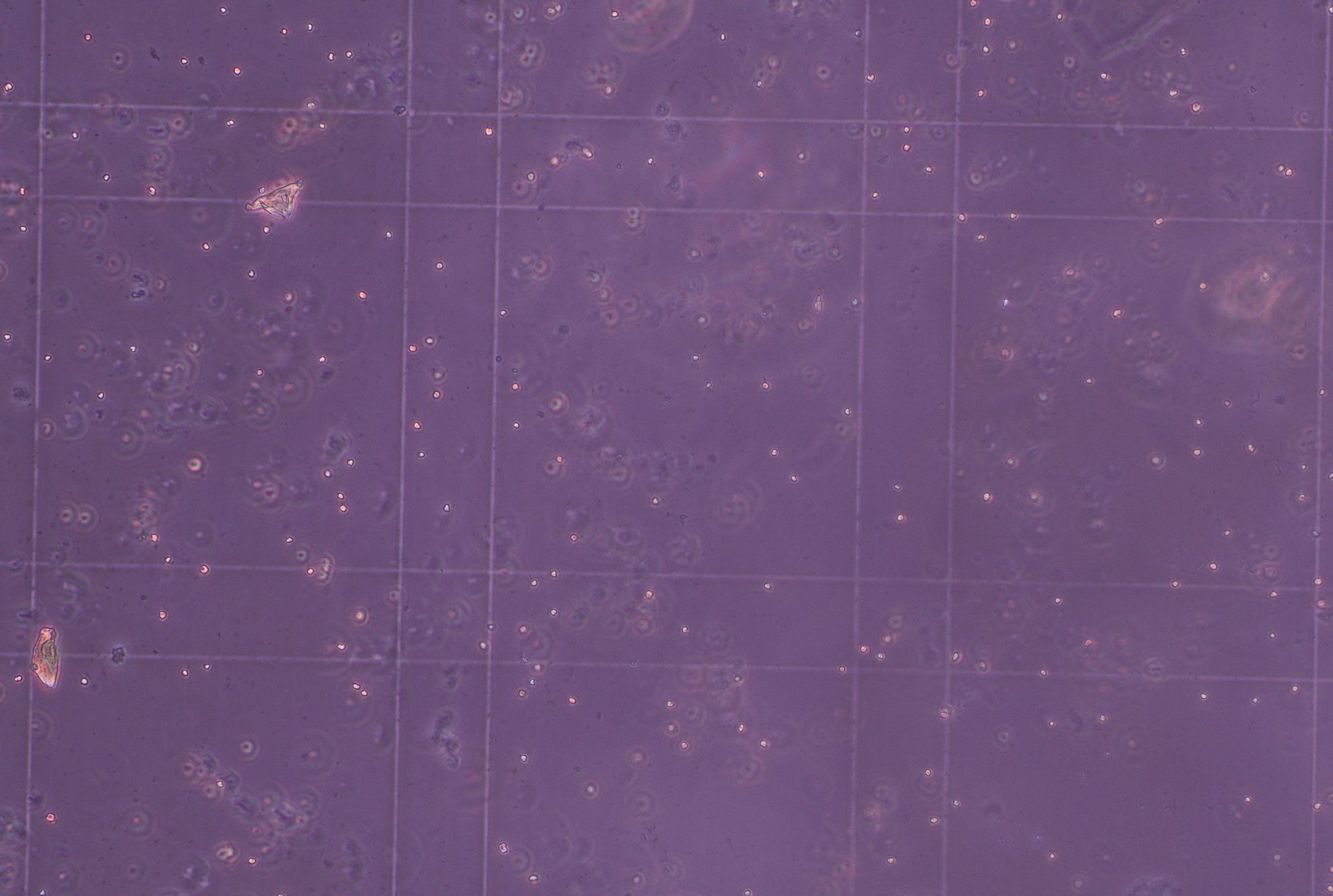 Phytoplankton unter dem Mikroskop © Lynn van Boheemen/Rugvin Foundation 